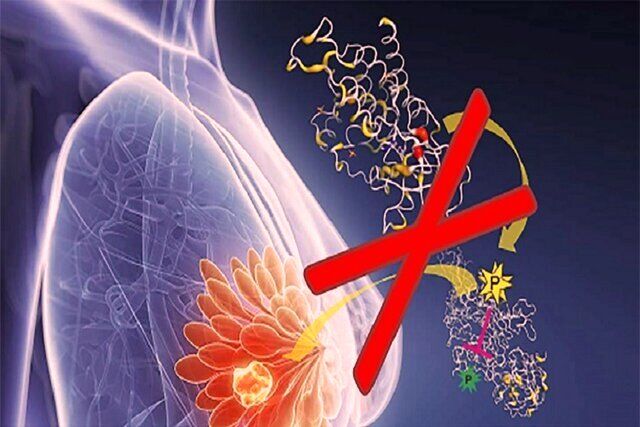 علت مهمی که زنان را به سرطان پستان نزدیک می‌کند