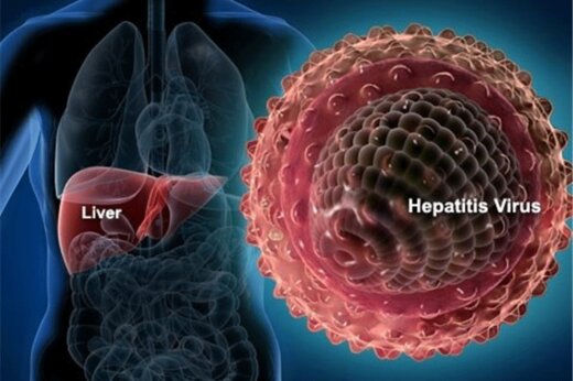 کنترل هپاتیت در ایران؛ واکسن زدن بهترین اقدام مقابله‌ای است