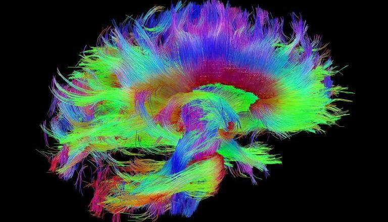 دقیق‌ترین نقشه مرکز حافظه در مغز را ببینید
