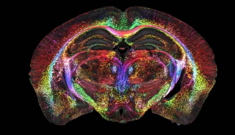 نگاه جدیدی به مغز: محققان موفق به ثبت اسکن‌هایی ۶۴ میلیون‌بار واضح‌تر از قبل شدند